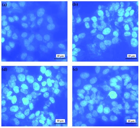 Effects of hBN NPs and Aβ on morphological changes in differentiated