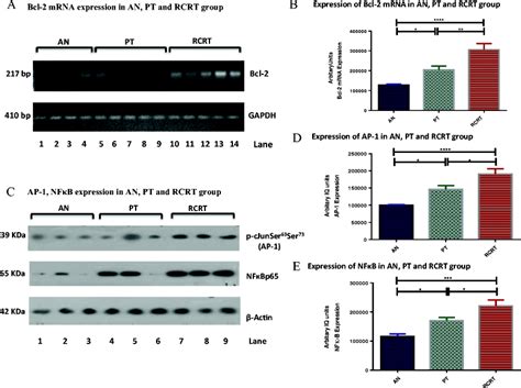 Bcl 2 gene transcription and expression of AP 1 NFκB WB in oral