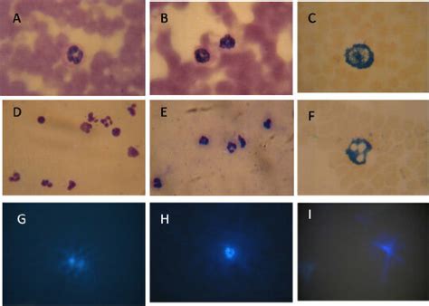 Images obtained with optical microscopy and immunofluorescence ...