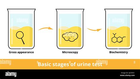 Étapes de base du test urinaire L analyse d urine peut inclure un