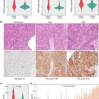 Expression Patterns Of Nqo Mrna And Protein In Hcc And Adjacent Normal