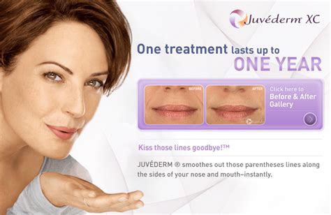 Juvederm Dermal Filler Cost Dallas Plano Austin Texas Med Spa