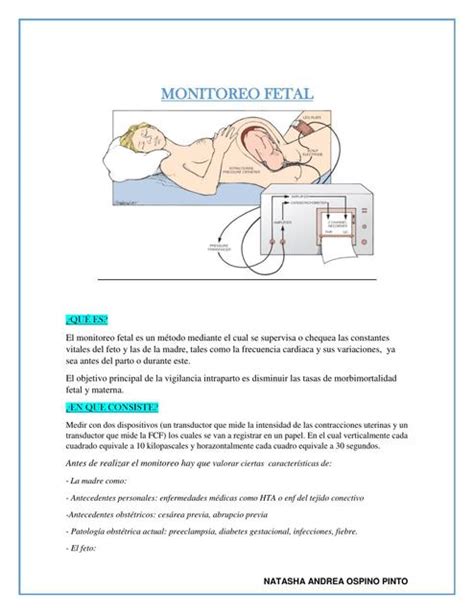 Resúmenes de Monitoreo fetal Descarga apuntes de Monitoreo fetal