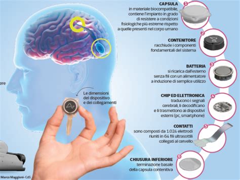 Il Primo Test Di Neuralink Su Un Uomo Tetraplegico Dubbi E Prospettive