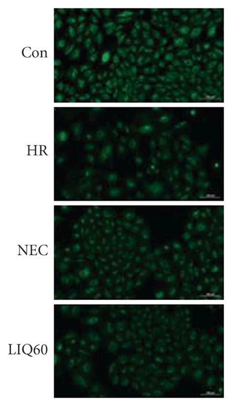 Mitochondrial Mass In H9c2 Cells Subjected To Different Treatments A