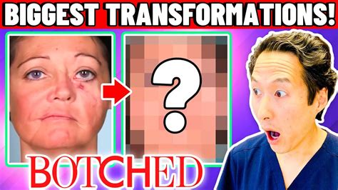 Plastic Surgeon Reacts To Botched The Most Amazing Transformations