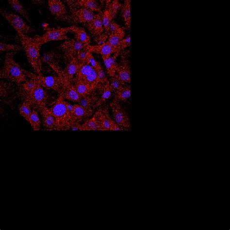 Isolation And Culture Of Primary Mouse Brain Microvascular Endothelial