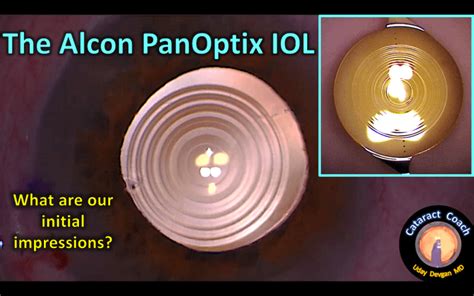 Initial Review Of The Alcon Panoptix Iol Cataract Coach™