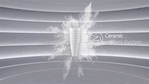 Neodent History Timeline Neodent Dental Implant Systems