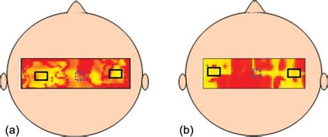 Group Level Activation T Maps Induced By The Finger Movement Task On