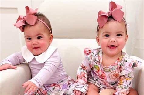 Formerly Conjoined Twins Celebrate Their First Birthday After Being