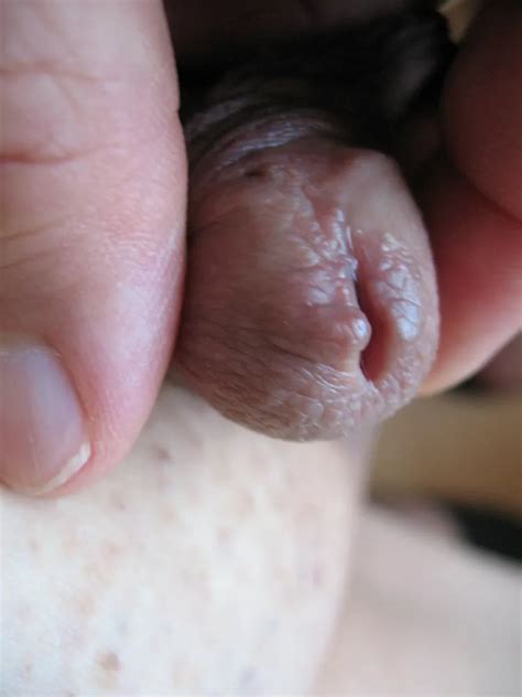 Open Peehole 37 Nude Pics XHamster