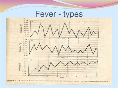 Ppt Fever A Clinical Approach Powerpoint Presentation Id3358160