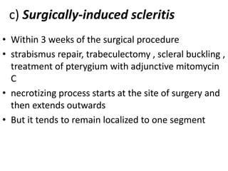 Scleritis | PPT