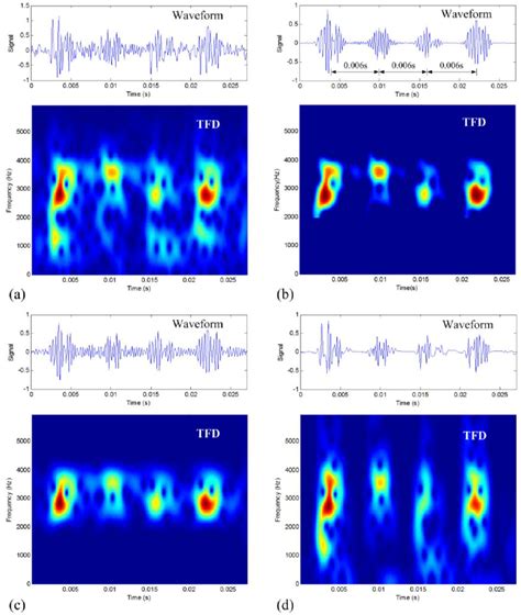 Denoising Results Of The Inner Race Defective Vibration Signal A Download Scientific