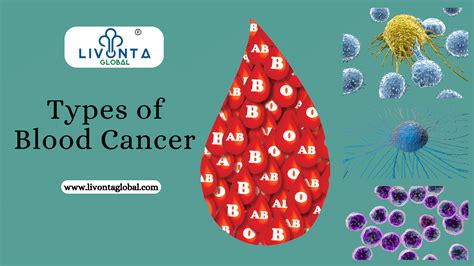 Blood Cancer Types