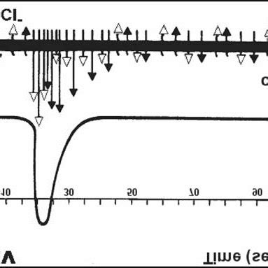 Change of membrane potential during depolarization and repolarization ...