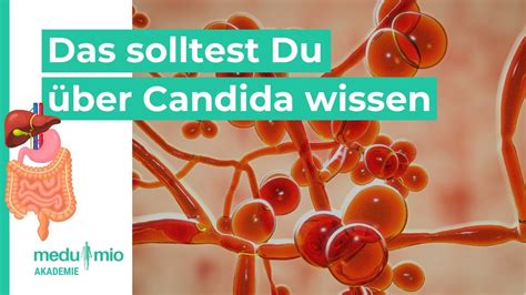 Chronische Infektionen Das Solltest Du Ber Candida Wissen Andreas