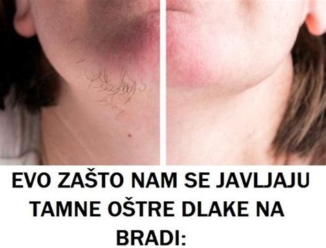 EVO ZAŠTO NAM SE JAVLJAJU TAMNE OŠTRE DLAKE NA BRADI Ako ih prate i