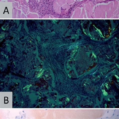 Histopathology Representative Histopathology Patient 2 Showing