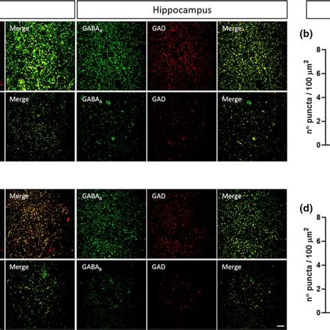 Decrease In The Synaptic Localization Of Inhibitory Synaptic Markers In