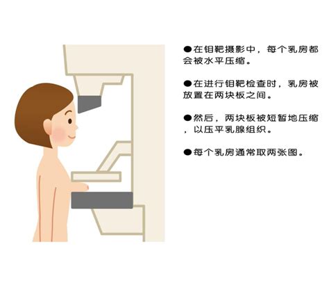 什么是乳腺钼靶？ 腾讯新闻