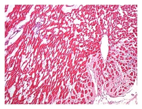 Myocardial Tissue In Light Microscope ×100 A Control B Con