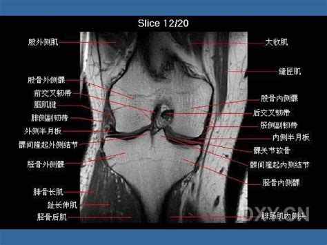 膝关节正常mri解剖 Word文档在线阅读与下载 无忧文档