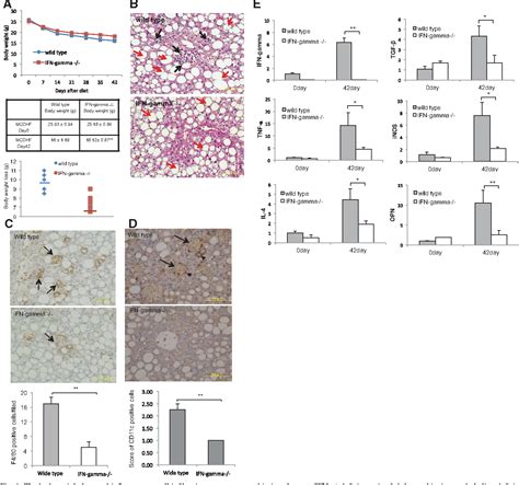 Figure 1 From Ifn γ Deficiency Attenuates Hepatic Inflammation And