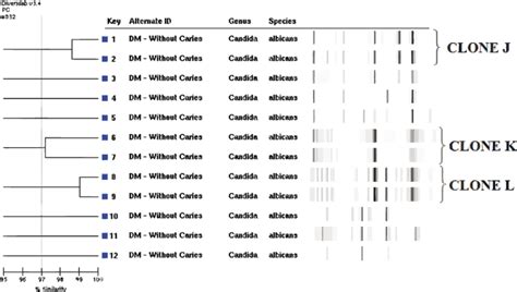 Dendrogram Analysis And Virtual Gel Image Of Rep PCR Fingerprint