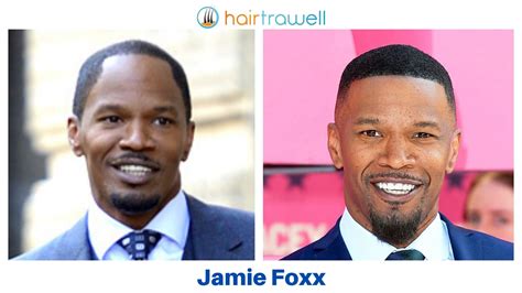 Jamie Foxx Hair Transplant