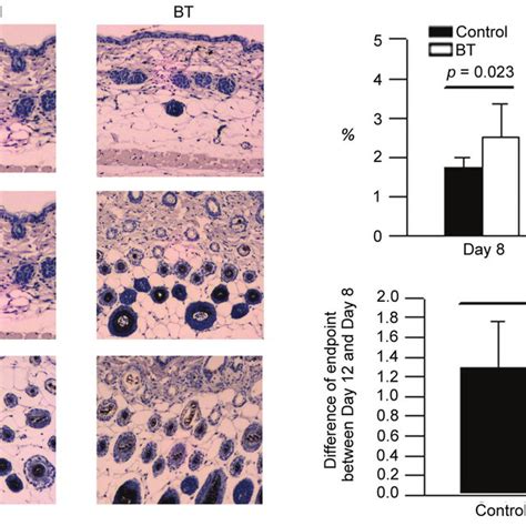 A Immunohistochemistical Stains Of FGF 5 B The Level Of FGF 5 On