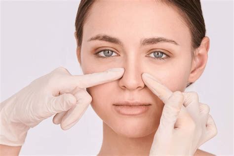 Unlocking The Beauty Of Non Surgical Rhinoplasty A Minimally Invasive