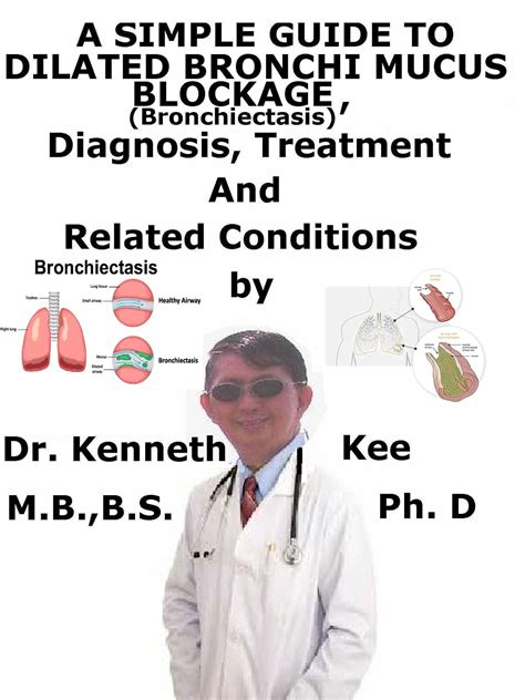 A Simple Guide To Dilated Bronchi Mucus Blockage Bronchiectasis