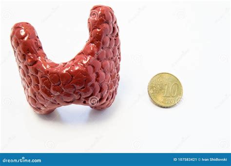 Concept Of Visualization Of Enlarged Thyroid Gland In Various Diseases