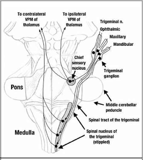 Trigeminal Tracts And Nuclei Are Superimposed Over A Dorsal View Of The