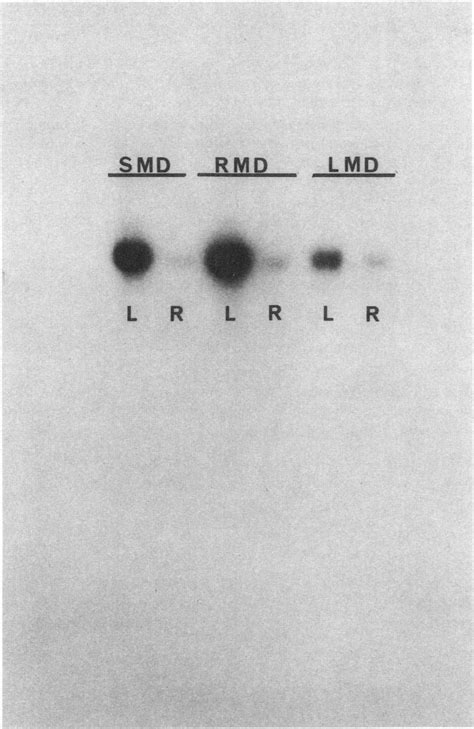 Northem Blot Hybridized With 32p Labeled Renin Cdna Download