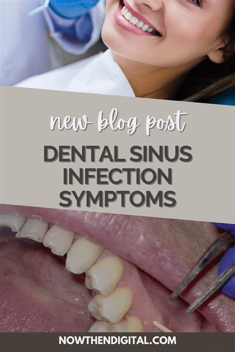 Dental Sinus Infection Symptoms Finally Revealed Now Then Digital