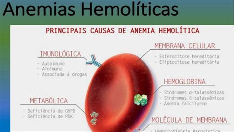 Anemia Hemolitica Lgv Lula Udocz