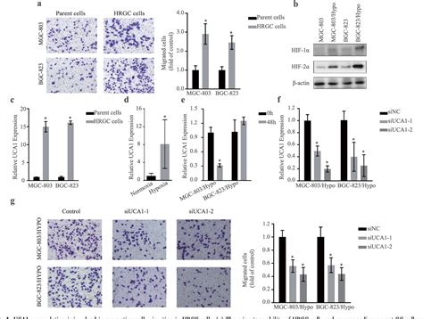 Figure From Long Noncoding Rna Uca Upregulation Promotes The