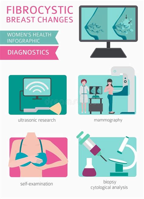 Fibrocystic Breast Changes Disease Medical Infographic Diagnostics