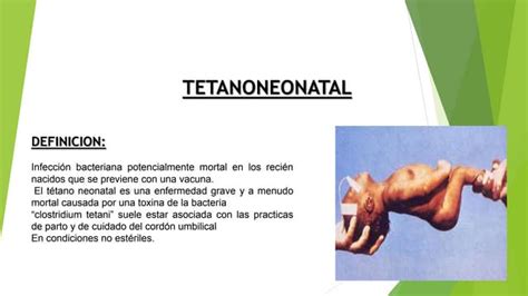 Tetano Neonatal Pptx Descarga Gratuita