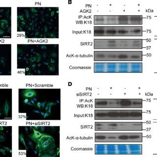 Pharmacological Inhibition Or Knockdown Of Sirt Impairs The Ability Of