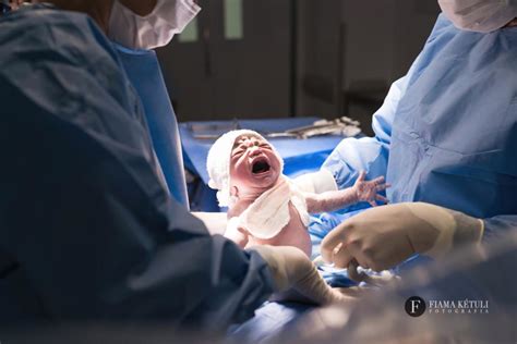 Fotografia De Parto Em Brasília O Primeiro Registro Do Seu Bebê O