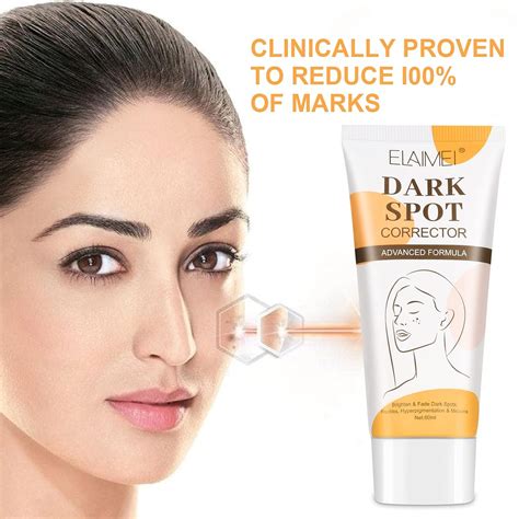 Buy Dark Spot Remover For Face 60ml 20 Fl Oz Dark Spot Corrector