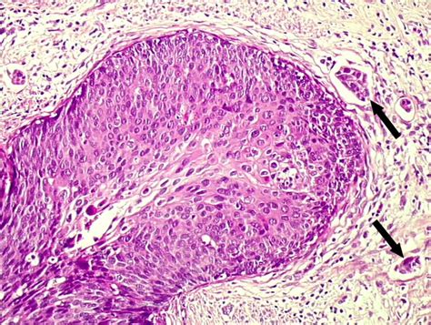 Histopathology Of The Uterine Cervix Digital Atlas