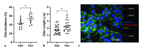 Fenoldopam Effectively Increases Macrophage Primary Cilia Incidence And