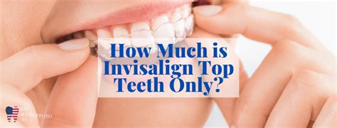 How Much Is Invisalign Top Teeth Only Invisalign Express