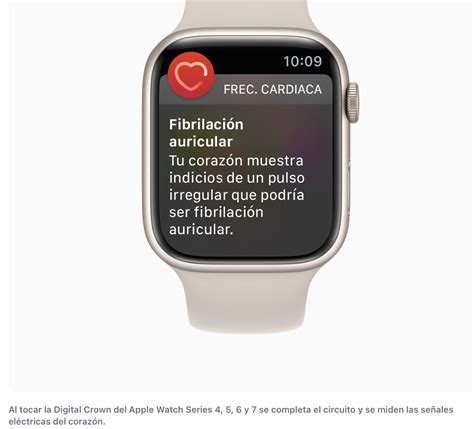 Ecg Y La Notificaci N De Ritmo Irregul Comunidad De Apple