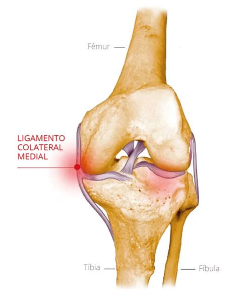 Ligamento Colateral Medial Lcm Dr Fabio Pacheco